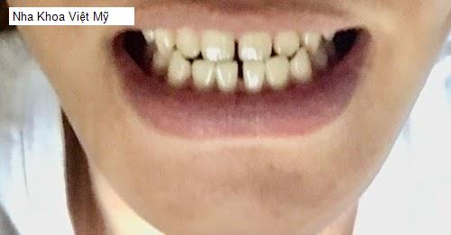 Hình ảnh Nha Khoa Việt Mỹ