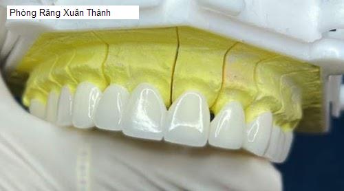 Hình ảnh Phòng Răng Xuân Thành